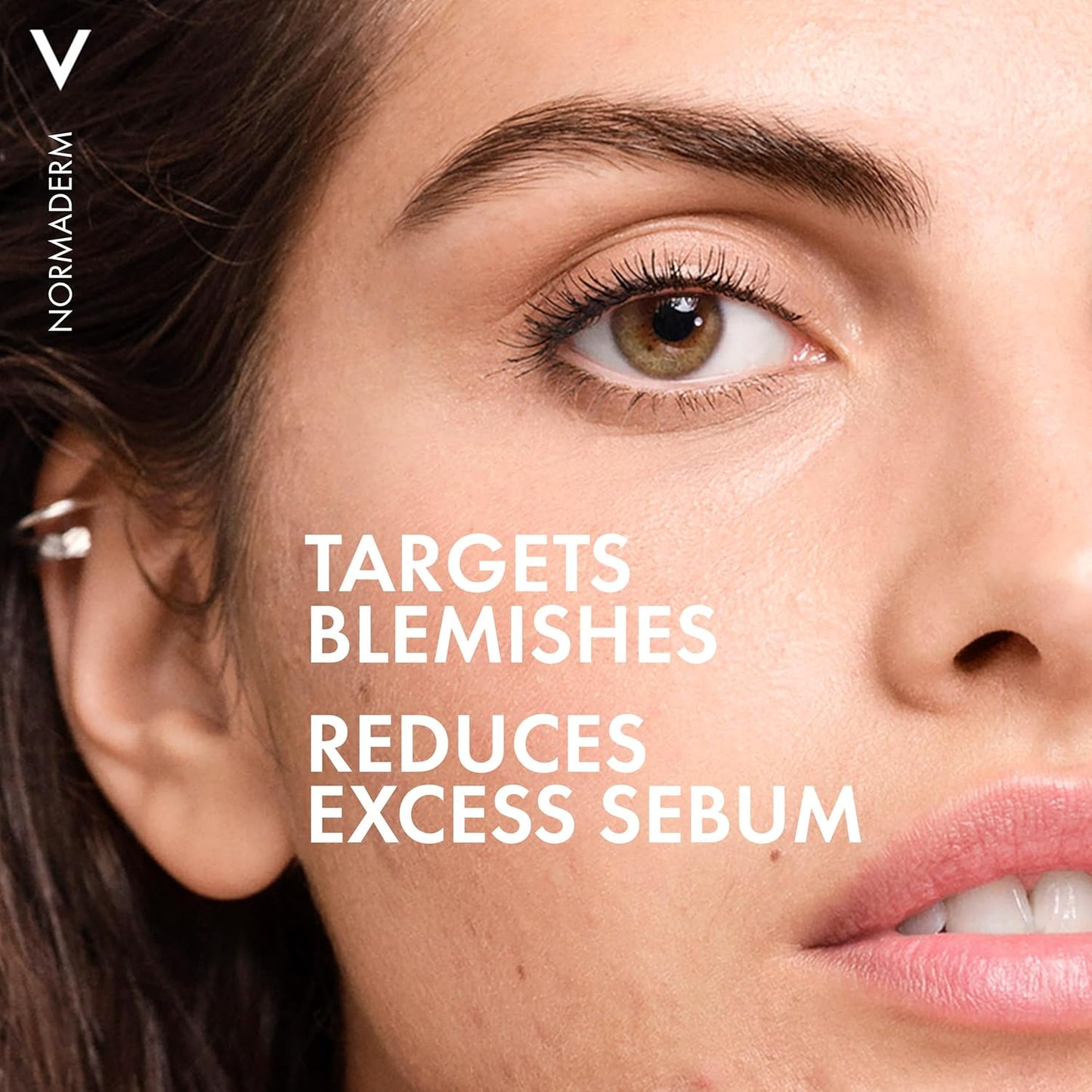 Vichy Normaderm Phyto Intensive Cleanser Gel MB158203